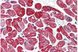 Human Heart (formalin-fixed, paraffin-embedded) stained with TPM1 antibody ABIN337101 at 5 ug/ml followed by biotinylated anti-mouse IgG secondary antibody ABIN481714, alkaline phosphatase-streptavidin and chromogen. (Tropomyosin antibody)