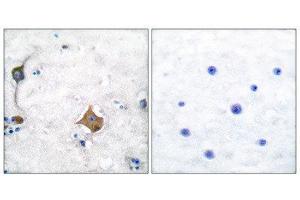 Immunohistochemistry (IHC) image for anti-Synaptophysin (SYP) (Internal Region) antibody (ABIN1848785) (Synaptophysin antibody  (Internal Region))