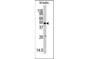Image no. 1 for anti-Methionyl-tRNA Synthetase 2, Mitochondrial (MARS2) (C-Term) antibody (ABIN360193) (MARS2 antibody  (C-Term))