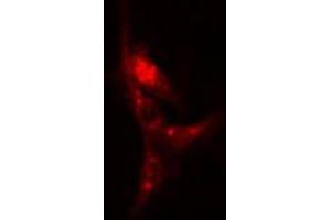 ABIN6266570 staining A-431 cells by IF/ICC. (KRT17 antibody  (C-Term))