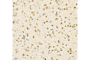 Immunohistochemistry of paraffin embedded mouse brain using Kcnh5 (ABIN7075159) at dilution of 1:100 (400x lens) (KCNH5 antibody)