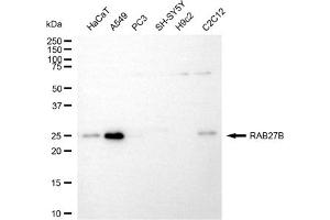 Western blotting analysis using RAB27B antibody (ABIN7800096).