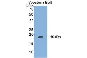 Western blot analysis of the recombinant protein. (alpha 2 Antiplasmin antibody  (AA 348-491))