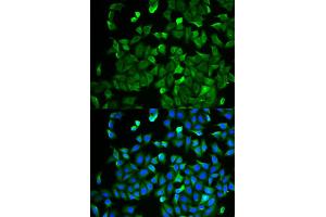 Immunofluorescence analysis of HeLa cells using NF2 antibody (ABIN5971315). (Merlin antibody)