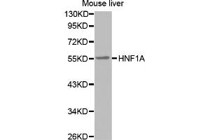 Western blot analysis of extracts of mouse liver, using HNF1A antibody (ABIN5971580). (HNF1A antibody)