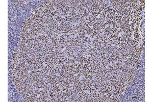 IHC analysis of MSH2 using anti-MSH2 antibody (ABIN7601369).