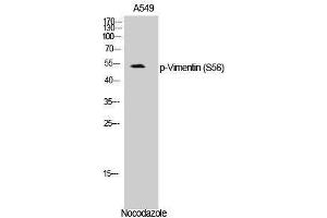 Western Blotting (WB) image for anti-Vimentin (VIM) (pSer56) antibody (ABIN3173297) (Vimentin antibody  (pSer56))