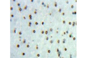 Used in DAB staining on fromalin fixed paraffin-embedded Brain tissue (CAN antibody  (AA 7-301))