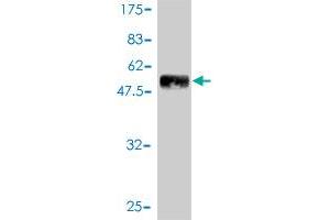 Western Blot detection against Immunogen (47. (PDGFRA antibody  (AA 25-218))
