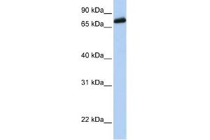 LRCH4 antibody used at 1 ug/ml to detect target protein. (LRCH4 antibody)