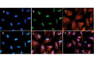 ImmunoFluorescence of Rabbit Anti-Histone H3 K9ac/K14ac Antibody. (Histone 3 antibody  (H3K9ac, H3K14ac))