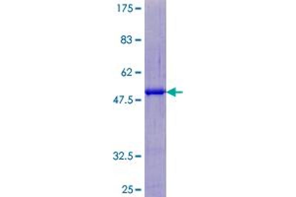 SART3 Protein (AA 1-129) (GST tag)
