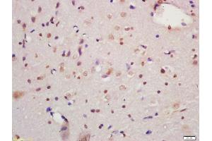 Formalin-fixed and paraffin embedded rat brain labeled with Anti-MAPK organizer 1 Polyclonal Antibody, Unconjugated (ABIN720475) at 1:200 followed by conjugation to the secondary antibody and DAB staining