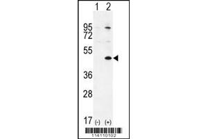 Western blot analysis of TGIF1 using rabbit polyclonal using 293 cell lysates (2 ug/lane) either nontransfected (Lane 1) or transiently transfected (Lane 2) with the TGIF1 gene. (TGIF1 antibody  (AA 208-237))