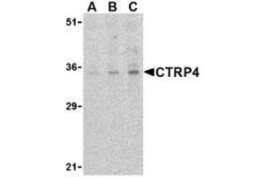 Western blot analysis of CTRP4 in rat brain cell lysate with AP30252PU-N CTRP4 antibody at (A) 1, (B) 2, and (C) 4 μg/ml. (C1QTNF4 antibody  (C-Term))
