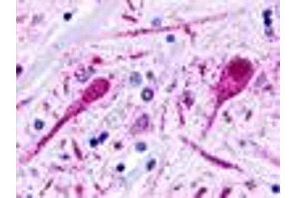 GPR58 antibody  (Cytoplasmic Domain)