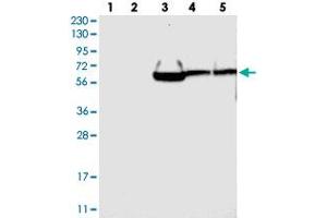Western blot analysis of Lane 1: RT-4, Lane 2: U-251 MG, Lane 3: Human Plasma, Lane 4: Liver, Lane 5: Tonsil with GRAMD1A polyclonal antibody . (GRAMD1A antibody)