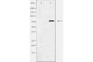 Western blot analysis of extracts from Jurkat cells using C1S antibody.