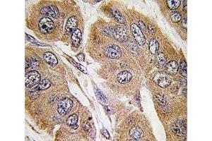 Immunohistochemistry (IHC) image for anti-Ribosomal Protein S6 Kinase, 70kDa, Polypeptide 1 (RPS6KB1) (AA 425-454) antibody (ABIN3032481)