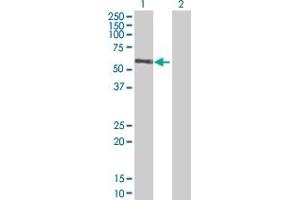 Western Blot analysis of RGL4 expression in transfected 293T cell line by RGL4 MaxPab polyclonal antibody. (RGL4 antibody  (AA 1-410))