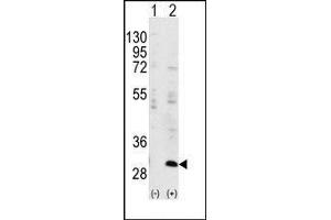Western blot analysis of IGFBP3(arrow) using rabbit polyclonal IGFBP3 Antibody. (IGFBP3 antibody  (Ser183))