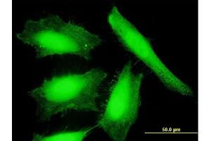 Immunofluorescence of purified MaxPab antibody to NXN on HeLa cell. (NXN antibody  (AA 1-435))
