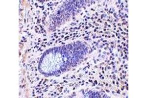 Immunohistochemistry (IHC) image for anti-Leucine Rich Repeat Containing 1 (LRRC1) (C-Term) antibody (ABIN1030477) (LRRC1 antibody  (C-Term))