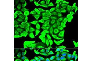 Immunofluorescence analysis of MCF-7 cells using DCD Polyclonal Antibody (Dermcidin antibody)