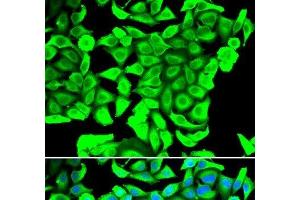 Immunofluorescence analysis of MCF-7 cells using DCD Polyclonal Antibody