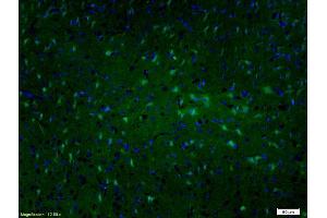 Formalin-fixed and paraffin embedded rat brain labeled with Anti-MAP2/MAP-2A. (MAP2 antibody  (AA 1-120))