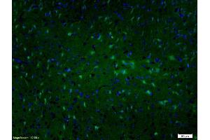 Formalin-fixed and paraffin embedded rat brain labeled with Anti-MAP2/MAP-2A. (MAP2 antibody  (AA 1-120))