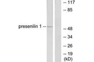 Western Blotting (WB) image for anti-Presenilin 1 (PSEN1) (AA 1-50) antibody (ABIN2889251) (Presenilin 1 antibody  (AA 1-50))