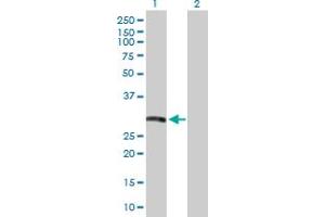 Western Blot analysis of HLA-DRB5 expression in transfected 293T cell line by HLA-DRB5 MaxPab polyclonal antibody. (HLA-DRB5 antibody  (AA 1-266))