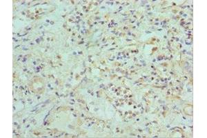 Immunohistochemistry of paraffin-embedded human kidney tissue using ABIN7151879 at dilution of 1:100