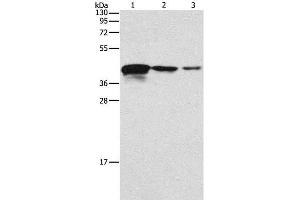 Western Blot analysis of Human endometrial carcinoma tissue, A172 and U937 cell using TWF2 Polyclonal Antibody at dilution of 1:800 (TWF2 antibody)