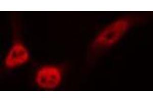 ABIN6276751 staining HeLa cells by IF/ICC. (ETS1 antibody  (Internal Region))