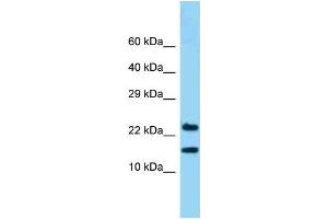 WB Suggested Anti-NDUFB10 Antibody Titration: 1. (NDUFB10 antibody  (C-Term))