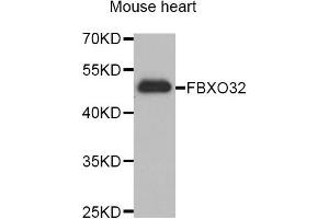Western blot analysis of extracts of Mouse heart cell lines, using FBXO32 antibody. (FBXO32 antibody)