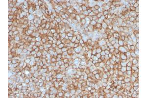 Immunohistochemistry (IHC) image for anti-Melanoma Cell Adhesion Molecule (MCAM) (AA 226-374) antibody (ABIN6940013)
