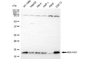 Western blotting analysis using NDUFB2 antibody (ABIN7799550).