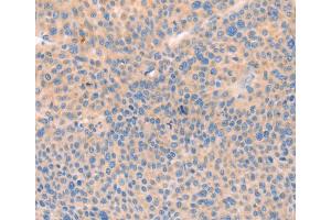 Immunohistochemistry (IHC) image for anti-CD109 (CD109) antibody (ABIN2426665) (CD109 antibody)