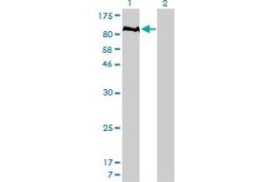 Western Blot analysis of PTPN22 expression in transfected 293T cell line by PTPN22 monoclonal antibody (M01), clone 4F6. (PTPN22 antibody  (AA 1-179))