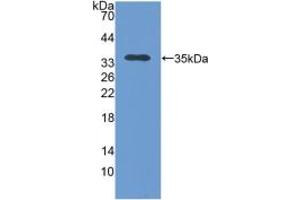 Western blot analysis of recombinant Human TOMM70A.