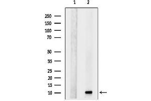 anti-High Affinity Immunoglobulin epsilon Receptor Subunit gamma (FCER1G) (C-Term) antibody
