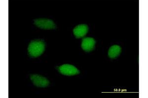 Immunofluorescence of purified MaxPab antibody to BLVRA on HeLa cell.