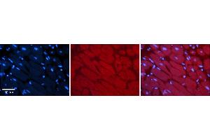 Immunohistochemistry (IHC) image for anti-MLX Interacting Protein (MLXIP) (Middle Region) antibody (ABIN2776519)