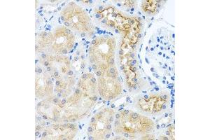 Immunohistochemistry of paraffin-embedded rat kidney using RPS2 antibody. (RPS2 antibody  (AA 1-293))