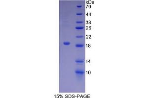 SDS-PAGE analysis of Human Biglycan Protein.