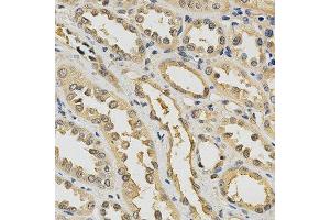 Immunohistochemistry of paraffin-embedded human kidney using PDGFRB antibody at dilution of 1:200 (x400 lens) (PDGFRB antibody  (AA 887-1106))