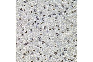 Immunohistochemistry of paraffin-embedded mouse liver using H2AFZ antibody (ABIN5973977) at dilution of 1/100 (40x lens). (H2AFZ antibody)